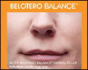 Belotero Balance